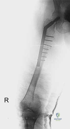 متابعة المرضى بعد الجراحة