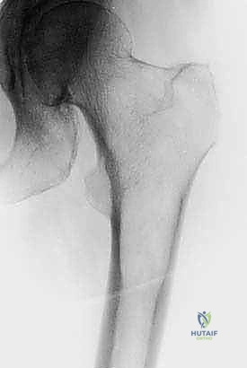 تخطيط الجراحة حسب الموقع