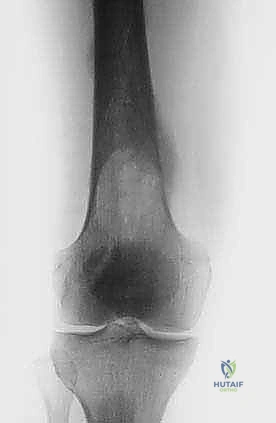 تقنيات التشخيص الشعاعي