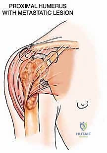 التقييم قبل الجراحة