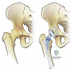 تقييم خيارات العلاج