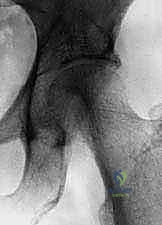 تقييم الألم والأعراض السريرية