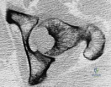 أدوات التشخيص الإشعاعي المتقدمة