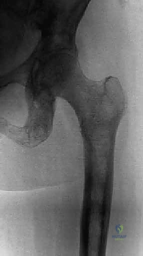 إغلاق الجرح الجراحي