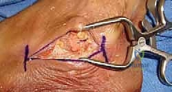 صورة توضح الخيارات العلاجية التحفظية