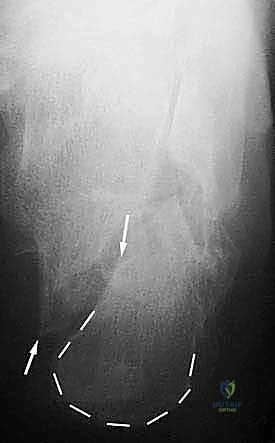 التحضير للتدخل الجراحي المتقدم
