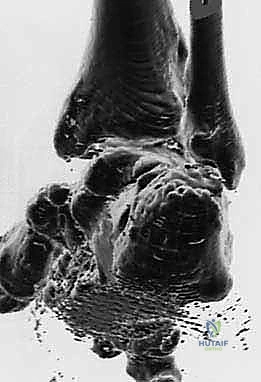 الأشعة السينية لتقييم الزوايا