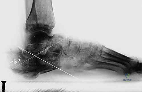 التصوير المقطعي المحوسب