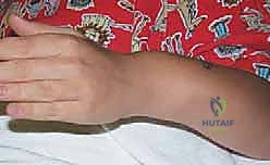 استخدام أحدث التقنيات الجراحية في غرفة العمليات