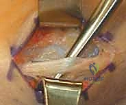 الفحص السريري وتحديد مناطق الألم حسب الحيز