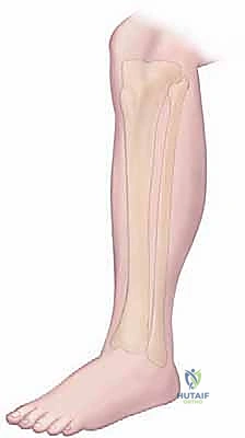 توضيح مناطق التنميل المرتبطة بانضغاط الأعصاب