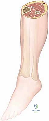 مقارنة بين حالات آلام الساق المختلفة