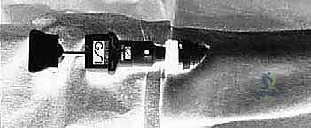 صورة طبية: بضع اللفافة لعلاج متلازمة الحيز الجهدي المزمنة: دليل شامل للمرضى مع الأستاذ الدكتور محمد هطيف