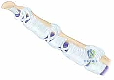 تشريح نظام البكرات والأوتار