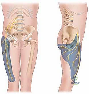 Peripheral Nerve Decompression: Lateral Femoral Cutaneous and Common Peroneal Nerve Masterclass