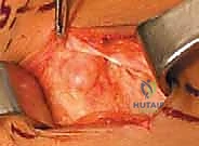 الاستعداد الجراحي وتقنيات الجراحة المجهرية