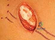 تشريح الأعصاب الطرفية ومسارات الانضغاط