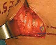 خيارات العلاج التحفظي والأدوية