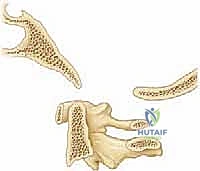 كسر في الفقرة العنقية الثانية نتيجة حادث سير