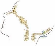صورة شعاعية توضح عدم الاستقرار في الفقرات العنقية