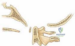 الأستاذ الدكتور محمد هطيف أثناء إجراء عملية جراحية معقدة