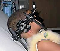 صورة توضيحية لـ تثبيت الفقرات العنقية الخلفي: دليل شامل لدمج الجمجمة-C2 والفقرة C1-C2