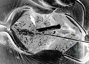 صورة توضيحية لـ تثبيت الفقرات العنقية الخلفي: دليل شامل لدمج الجمجمة-C2 والفقرة C1-C2