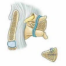 Illustration of line is drawn - Dr. Mohammed Hutaif