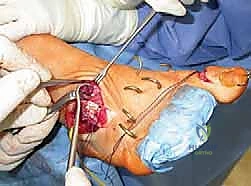 Clinical Image