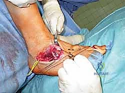 Clinical Image