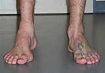 Clinical Image