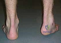 Clinical Image