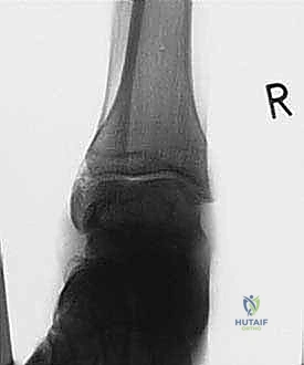 Clinical Image