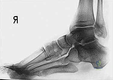 Clinical Image