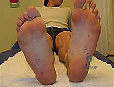 Clinical Image