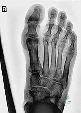 Clinical Image