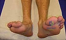 Clinical Image