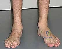 Clinical Image