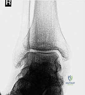 Clinical Image