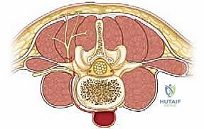 Posterior Spinal Exposure for Scoliosis Correction: An Intraoperative Masterclass