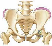 التشخيص الإشعاعي لأنواع الجنف المختلفة