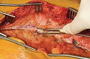 التحضير المسبق والتصوير الإشعاعي قبل الجراحة