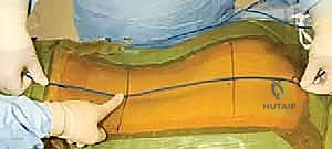 المعالم التشريحية للعمود الفقري من الخلف