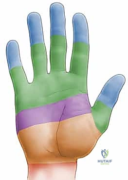 صورة توضيحية لـ إعادة بناء أوتار الأصابع المرنة على مرحلتين: دليل شامل لاستعادة وظيفة اليد