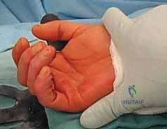 سحب الطعم الوتري عبر الغمد الجديد بسلاسة