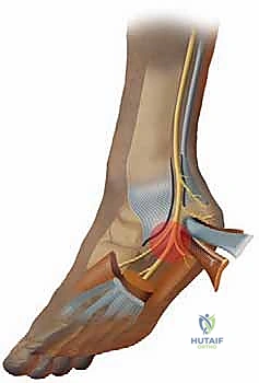 التشريح الدقيق للأعصاب في منطقة الكاحل والقدم