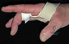 الدكتور محمد هطيف أثناء إجراء فحص دقيق لليد