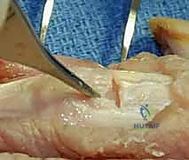 توضيح الفرق بين نهايات الأوتار المقطوعة والسليمة