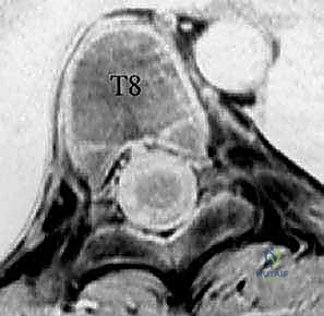 توضيح الأوتاد الفقرية