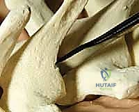 الوصول الجراحي وكشف الفقرات